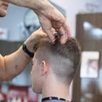Hair loss in men