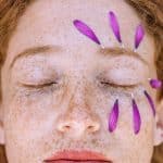 how to get rid of comedones